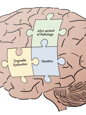 Piecing Together the Parkinson’s Puzzle – Maximizing Function & Improving Intervention