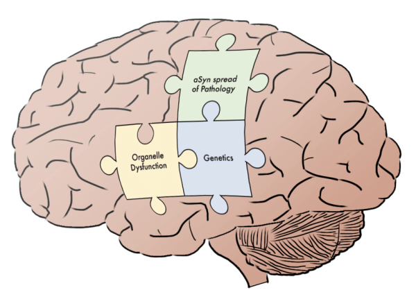 Piecing Together the Parkinson’s Puzzle – Maximizing Function & Improving Intervention